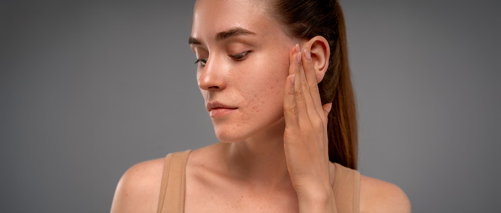 CO NA BLIZNY PO TRĄDZIKU? SKUTECZNE METODY ICH USUNIĘCIA