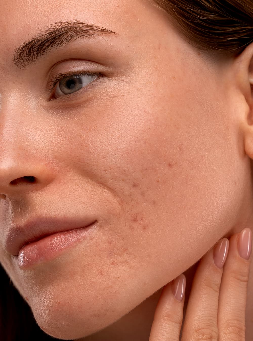 najlepszy krem do twarzy dla skóry trądzikowej