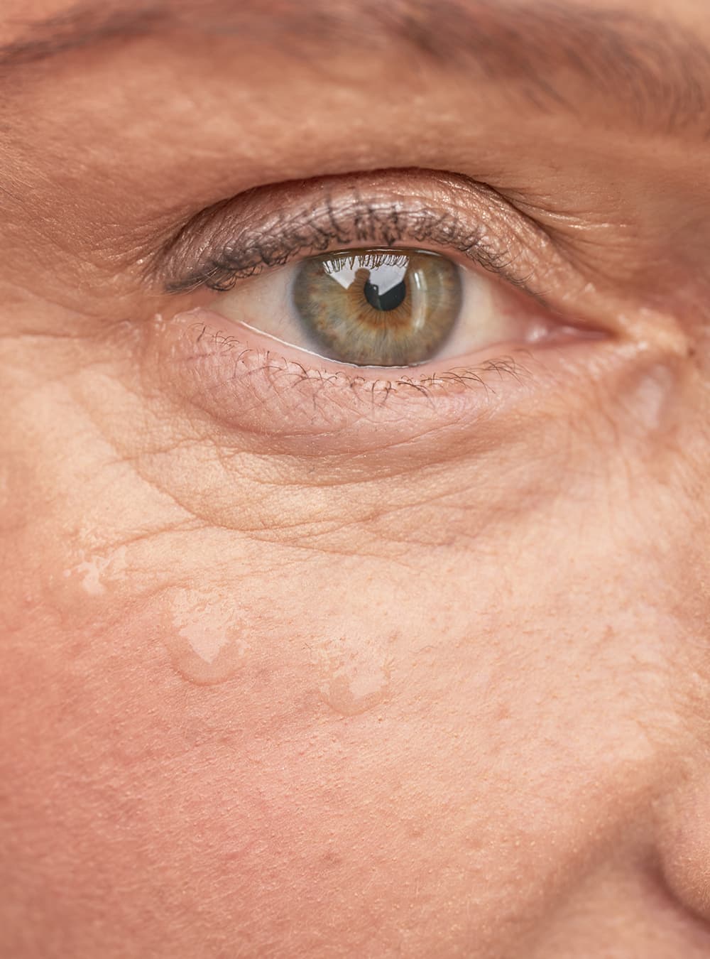 najlepszy krem do twarzy dla skóry trądzikowej